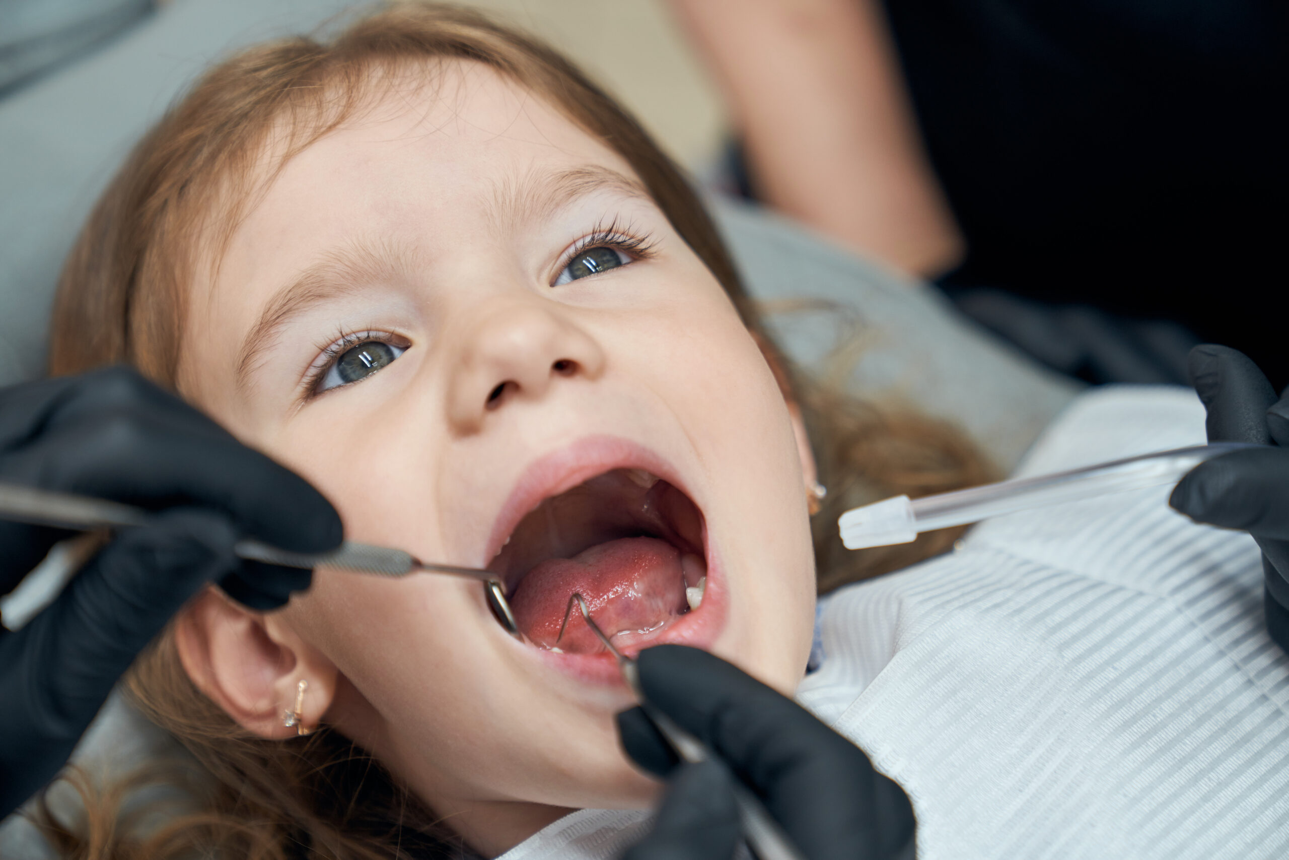 Qual a Idade Ideal para a Criança Ir ao Dentista?